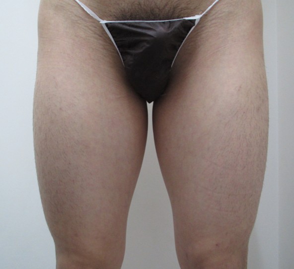 Before